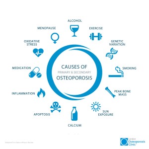 Causes of Osteoporosis