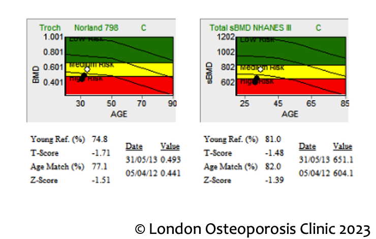 Diagnosing Osteoporosis and Determining Bone Strength by DEXA Scan