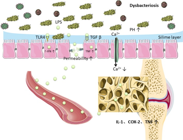 The Gut-Bone Connection: Harnessing Microbiota for Osteoporosis Prevention and Care