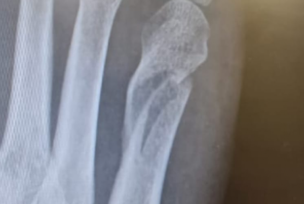 3D medical illustration of nerve cells and neurons representing the nervous system