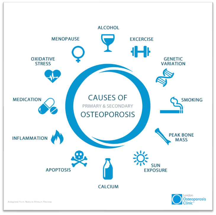Infographic depicting causes of primary and secondary osteoporosis. Key factors include menopause, alcohol, exercise, genetic variation, smoking, peak bone mass, sun exposure, calcium, medication