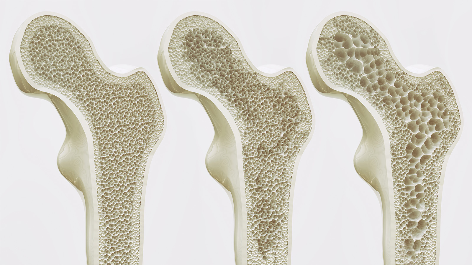 Why a DEXA Scan for Bone Health Targets the Hips and Spine
