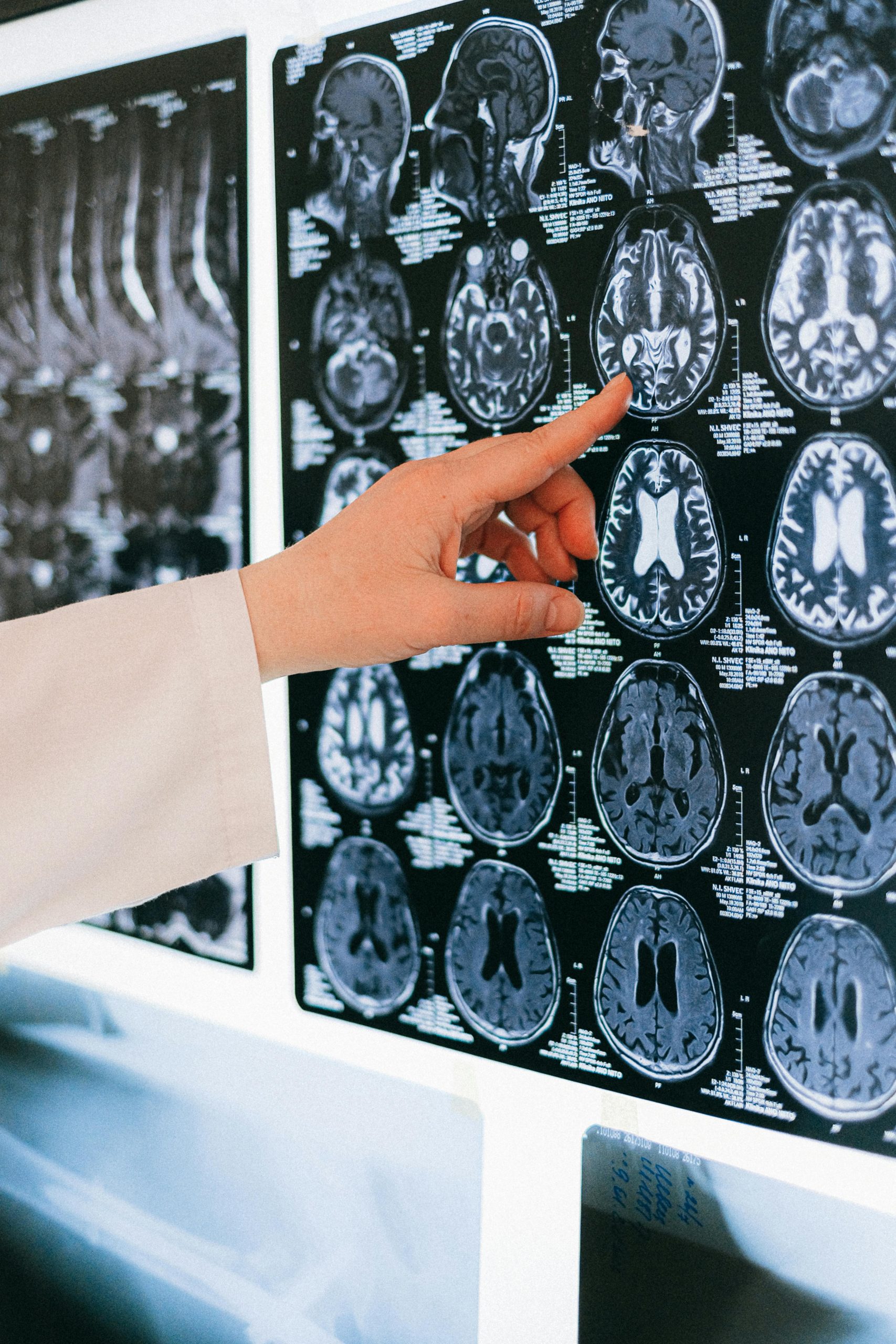 CT Scans, Radiation, and Bone Health: What You Need to Know