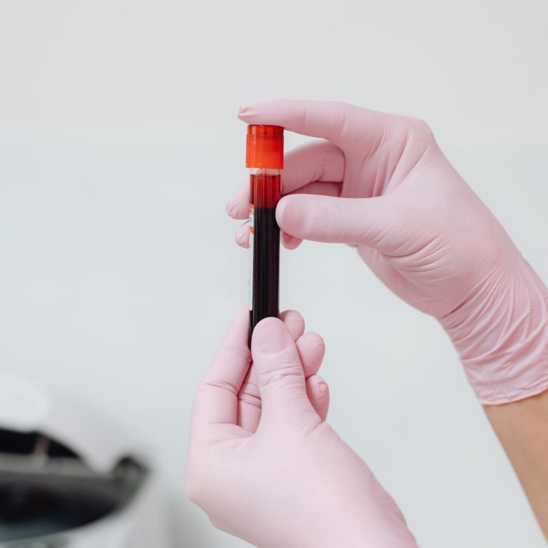 Gloved hands holding a blood sample tube for laboratory testing